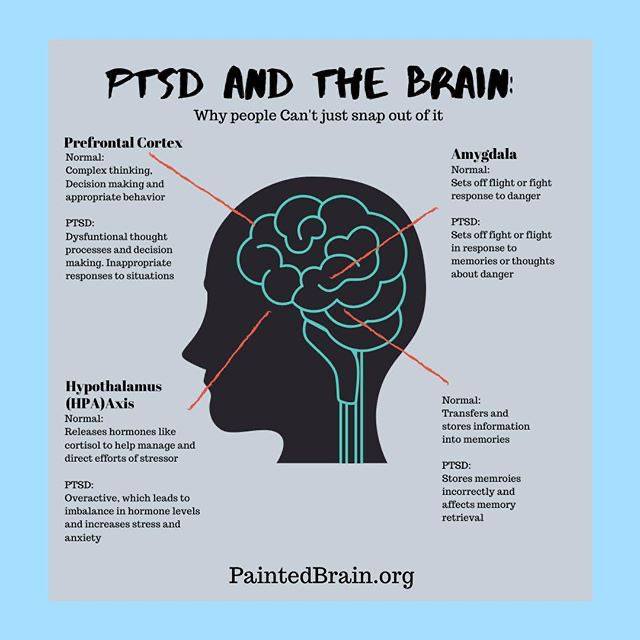 PTSD and the Brain: Why People Can't Just Snap Out Of It